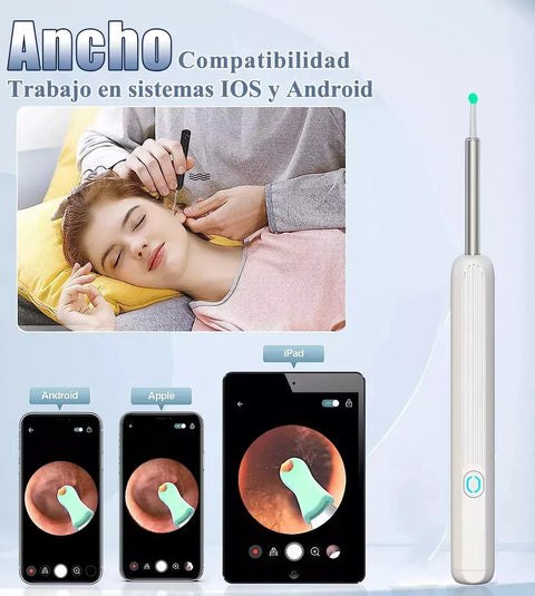 Yixoo Spiral Ear Cleaner with Endoscope Camera