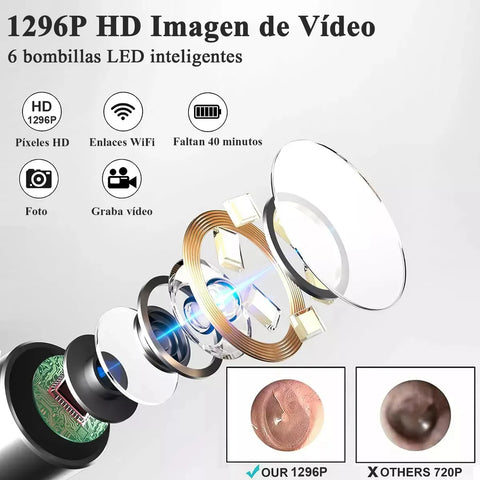 Yixoo Spiral Ear Cleaner with Endoscope Camera