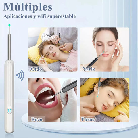 Yixoo Spiral Ear Cleaner with Endoscope Camera